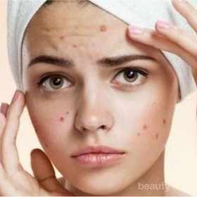 [FORUM] Gejala pake kosmetik baru