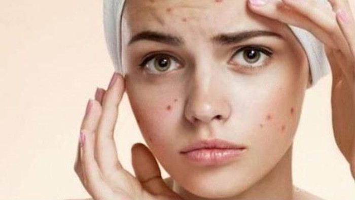 [FORUM] Gejala pake kosmetik baru