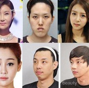 9 Operasi Plastik Paling Populer di Korea Selatan, Tertarik Coba?