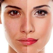 [FORUM] Ini loh girls manfaat body lotion selain melembabkan!