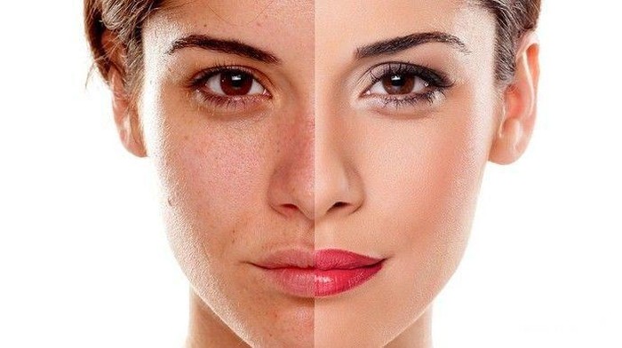 [FORUM] Ini loh girls manfaat body lotion selain melembabkan!