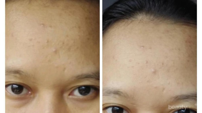 [FORUM] Paraaaah!! Cooling Water Sleeping Dari Azarine Mask Bikin Aku Nangis!!!!