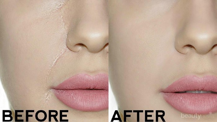 [FORUM] Biar gak creasing pas pake foundie gimana ya?