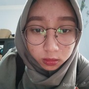 [FORUM] Boleh ga sih setelah menggunakan toner cuka apel menggunakan acnol?