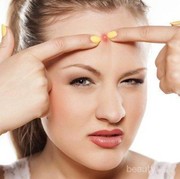5 Fakta Penyebab Jerawat Datang Terus Tanpa 'Permisi'