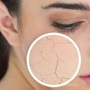 [FORUM] saran dong skincare buat kulit kering, kusam, berjerawat?