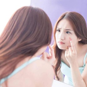 Mudah Banget! Hanya 4 Langkah untuk Hilangkan Jerawat