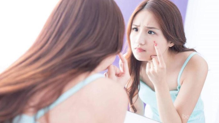 Mudah Banget! Hanya 4 Langkah untuk Hilangkan Jerawat