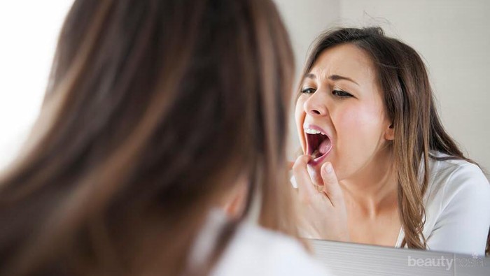 Lagi Sariawan? Wah, Kamu Bisa Obati dengan Bumbu Dapur yang Ada di Rumah Ini, Lho!