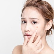 Ternyata 6 Bahan Berbahaya Ini Penyebab Jerawat Semakin Parah, Perhatikan Lagi Ladies!
