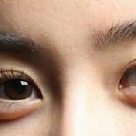 [FORUM] Skincare apa yang ampuh untuk menghilangkan kantung mata???