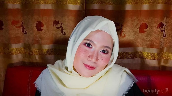 [FORUM] Demam model freckles