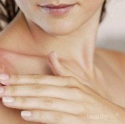 Mengapa Kulit Terasa Perih Setelah Terkena Matahari? Yuk Cari Tahu!