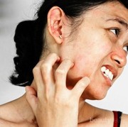 Kenali Penyebab dan Langkah Tepat Mengobati Alergi Pada Kulit Wajah!