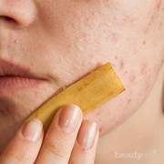 Sudah Tahukah Ladies Kalau Kulit Pisang Miliki Banyak Manfaat untuk Kulit Wajah?