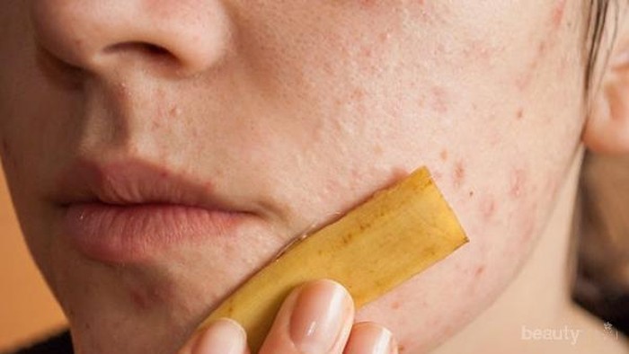 Sudah Tahukah Ladies Kalau Kulit Pisang Miliki Banyak Manfaat untuk Kulit Wajah?