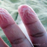 [FORUM] tangan keriput tanda kedinginan?masa sih?