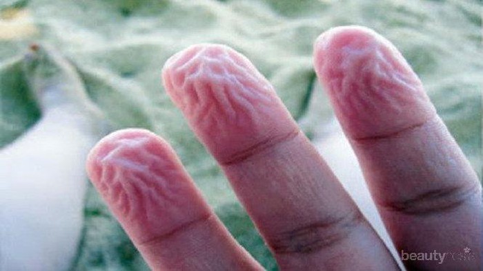 [FORUM] tangan keriput tanda kedinginan?masa sih?