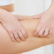 Cara Menghilangkan Stretch Mark dengan Lotion, Tubuh Mulus dengan Praktis!