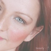 [FORUM] Kulitku gampang merah, apa berarti sensitif?