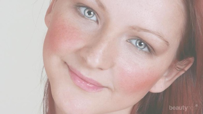 [FORUM] Kulitku gampang merah, apa berarti sensitif?