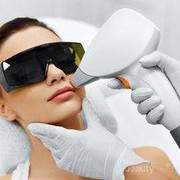Pengen Nyobain Laser Wajah? Yuk, Baca Dulu Fakta-fakta Menariknya di Sini!