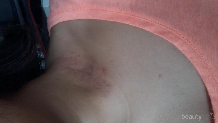 [FORUM] Sebel Deh! Alergi sama aksesoris!