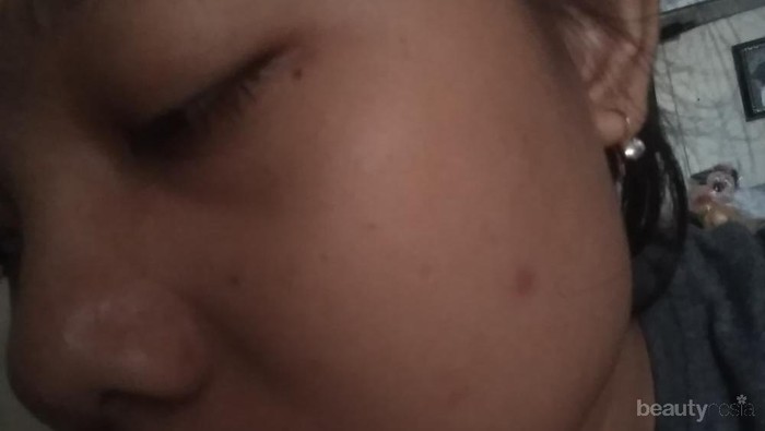 [FORUM] Setelah pemakaian Viva Milk Cleanser-Face tonic Lemon Hari Pertama