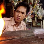 [FORUM] Waduh, orang satu ini punya muatan listrik!