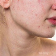 [FORUM] Hentikan penggunaan kosmetik jika muncul tanda-tanda ini!