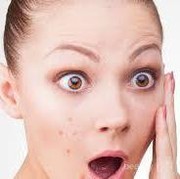 (FORUM) Dear obat atau produk apa yah buat ngilangin bekas jerawat yang ampuh banget