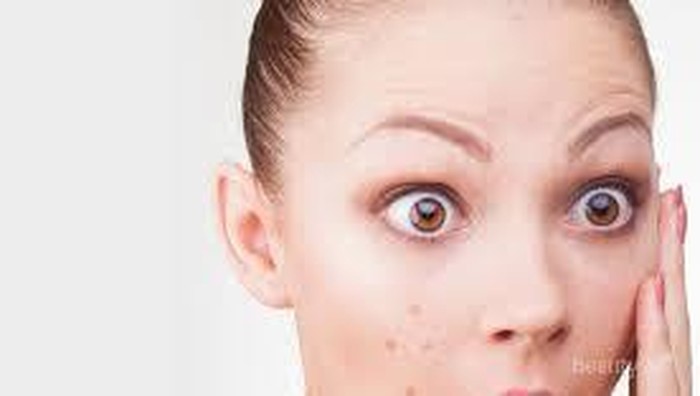 (FORUM) Dear obat atau produk apa yah buat ngilangin bekas jerawat yang ampuh banget