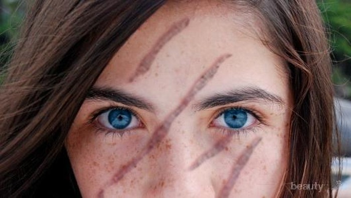 Mau Menghilangkan Bekas Luka dengan Cepat? Cobain Produk Ini Aja!