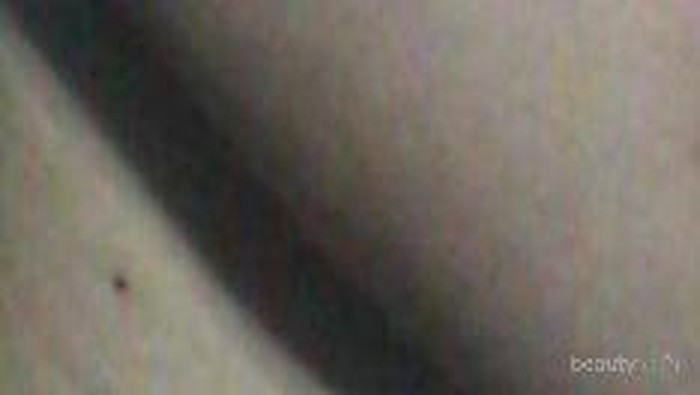 [FORUM] Alergi gara gara pake gel aloe vera!