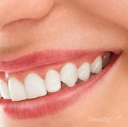 [FORUM] Gusi aku yang paling belakang sakit, apa tandanya mau tumbuh gigi?