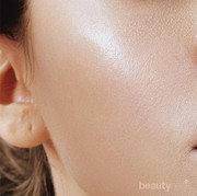 [FORUM] Kok muka aku selalu berminyak ya?