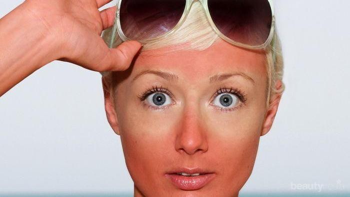 [FORUM] Butuh Skin Care untuk ngeratain wajah yang belang nih!