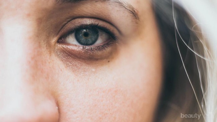 Punya Mata Panda? Intip Tips Menutupinya Hanya dengan Makeup!