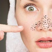 Jangan Anggap Sepele, 5 Hal Ini Bisa Jadi Penyebab Komedo Hitam di Wajah!