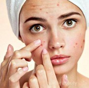 Alergi Kulit Bikin Bete? Ada Solusi Ampuh Untuk Kamu!