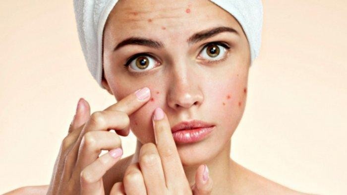 Alergi Kulit Bikin Bete? Ada Solusi Ampuh Untuk Kamu!