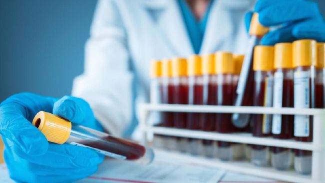 Blood Test, Blood, Medical Sample, Test Tube