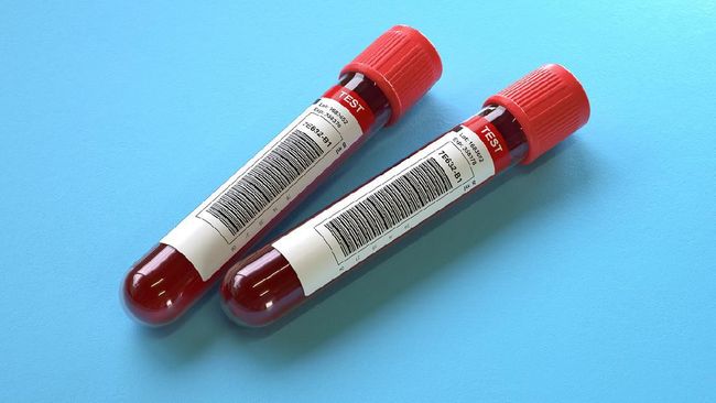 Kementerian Kesehatan Indonesia akan memulai uji klinis terapi sel punca mesenkimal untuk pasien Covid-19.