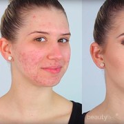 Yuk, Tampil Percaya Diri dengan Make Up Natural untuk Si Kulit Berjerawat!