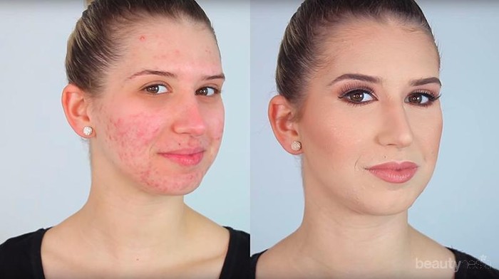 Yuk, Tampil Percaya Diri dengan Make Up Natural untuk Si Kulit Berjerawat!