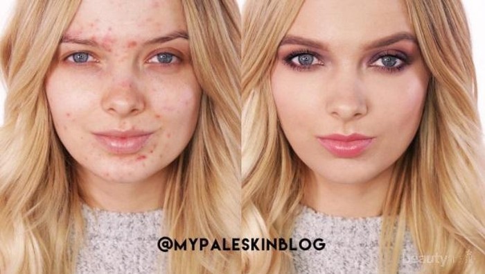 Tips Make Up Natural Super Flawless untuk Wajah dengan Kulit Berjerawat