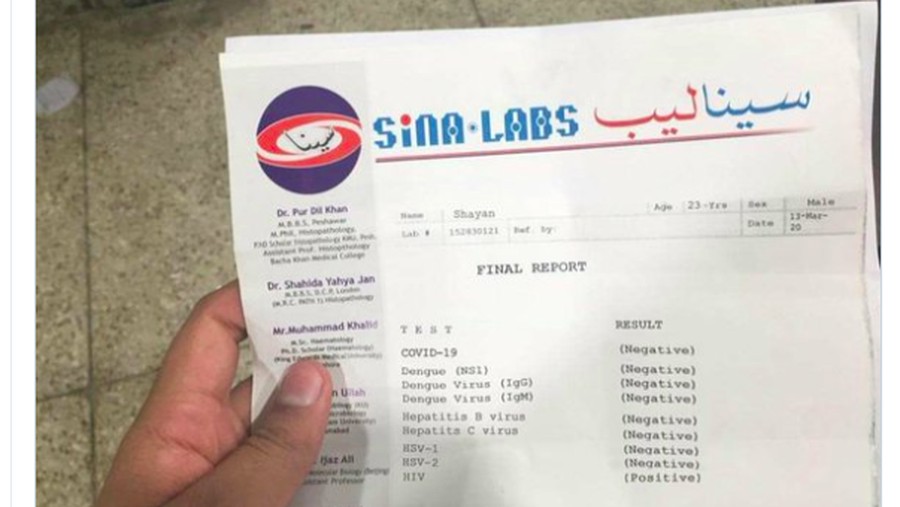 Di laman Twitter tengah viral hasil lab seseorang di luar negeri terkait tes COVID-19.