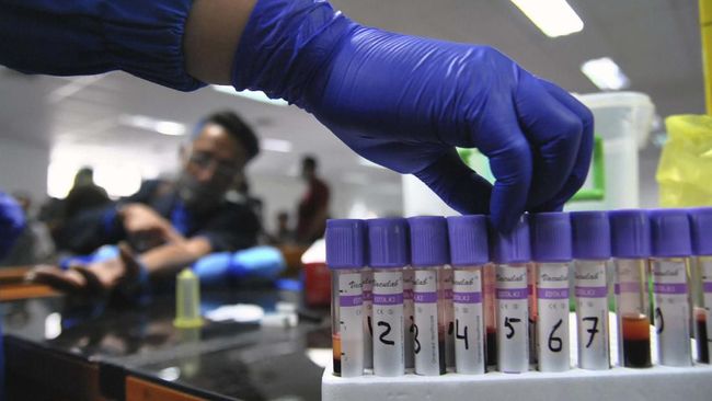 Data kasus Covid-19 Indonesia diduga masih terbatas, karena itu perlu dilakukan tes secara masif untuk rencana penanggulangan yang lebih matang.
