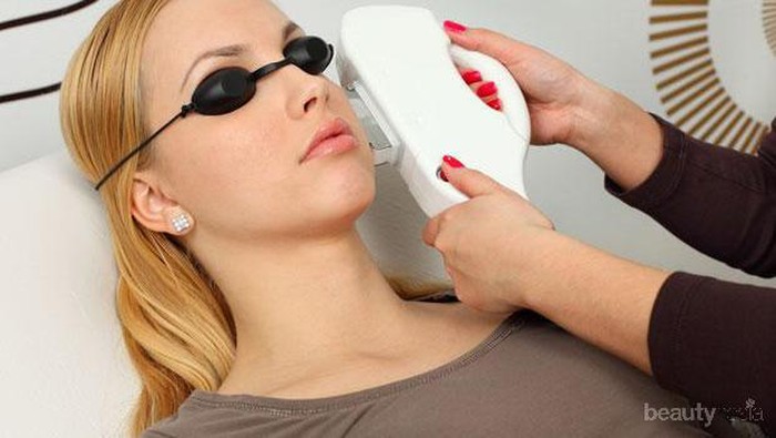 Benarkah Metode Laser Sangat Ampuh Menghilangkan Bekas Jerawat? Cari Tahu Yuk!
