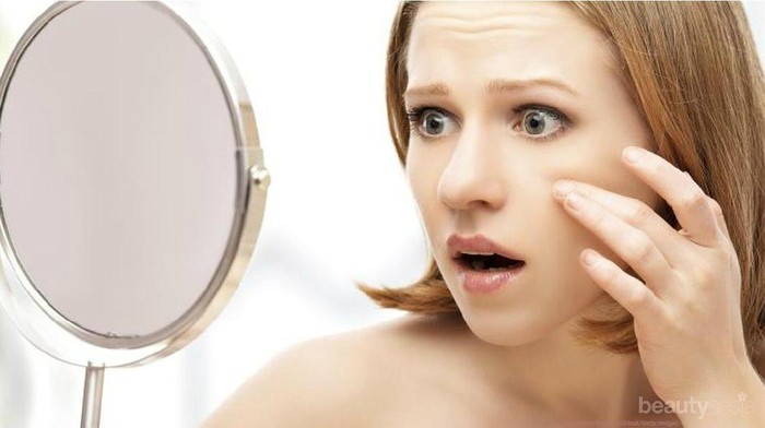 Yuk, Intip Apa Saja Penyebab Munculnya Komedo Hitam di Wajah Kamu